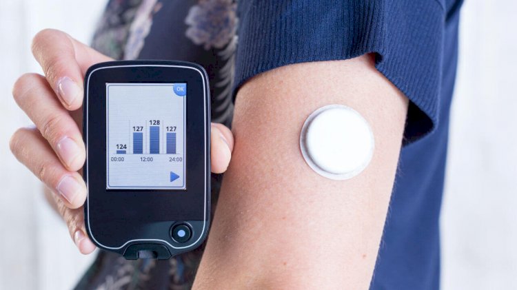 Novo sensor para monitorar pacientes com diabetes é lançado no Brasil